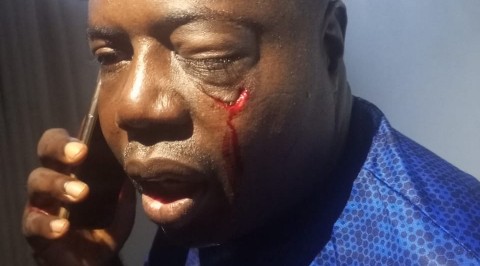 Hoodlums Attack Chairman Oyo State Sports Council, Ibadan