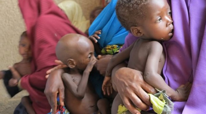 Experts bemoan malnutrition rate in Kano